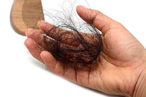Nguyên nhân gây rụng tóc