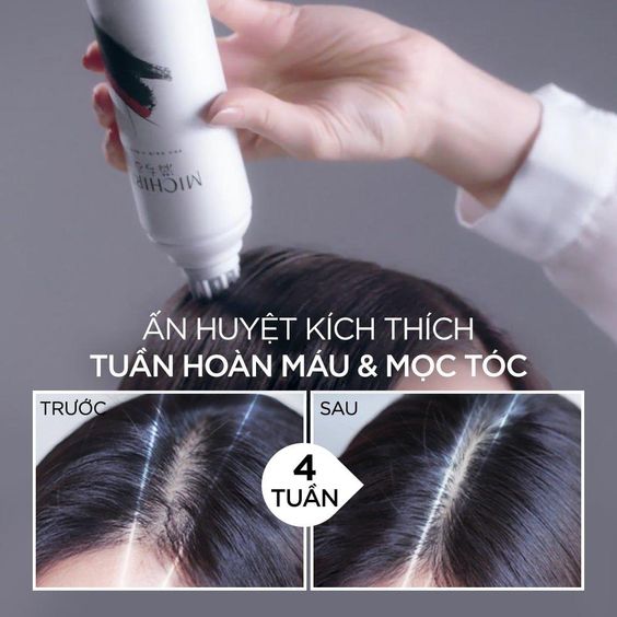 Sản phẩm chăm sóc tóc kích thích mọc tóc có tác dụng tốt 