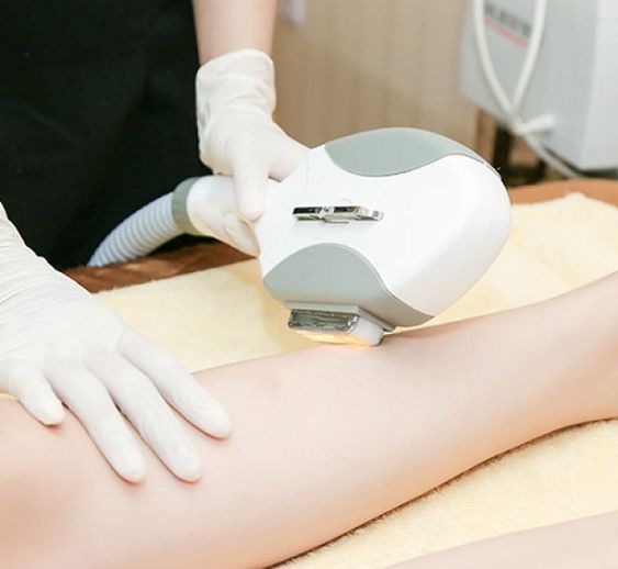 Triệt lông vĩnh viễn 